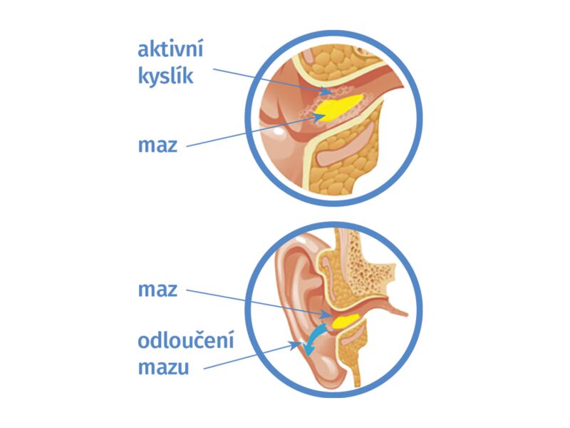 Audixol Oxiclean víceúčelový ušní sprej 30 ml