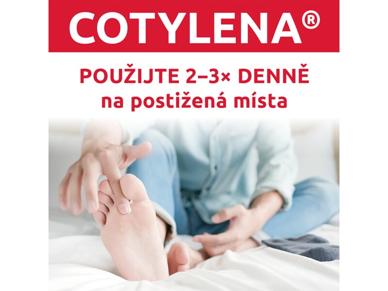 Cotylena 10 mg/g krém 20 g