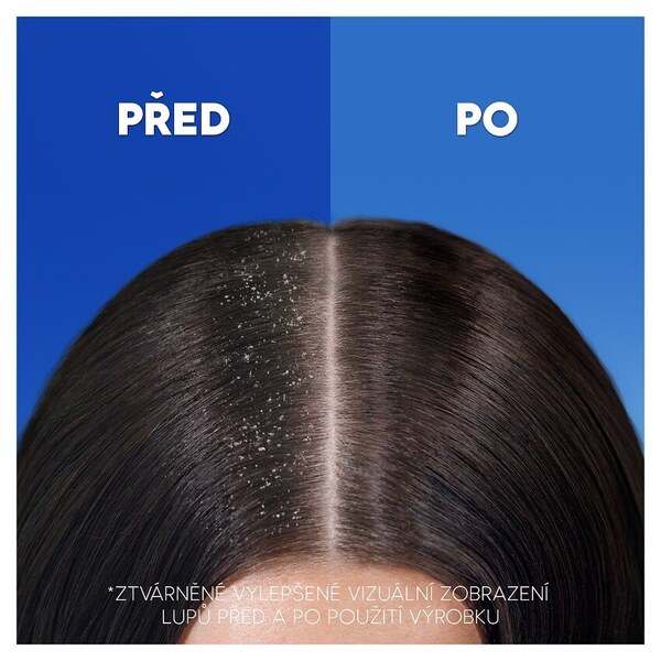 Head&Shoulders Classic Clean šampon 2v1 360 ml