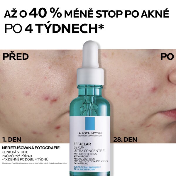 La Roche-Posay Effaclar Duo+ sérum 30 ml La Roche-Posay Effaclar Duo+ sérum 30 ml
