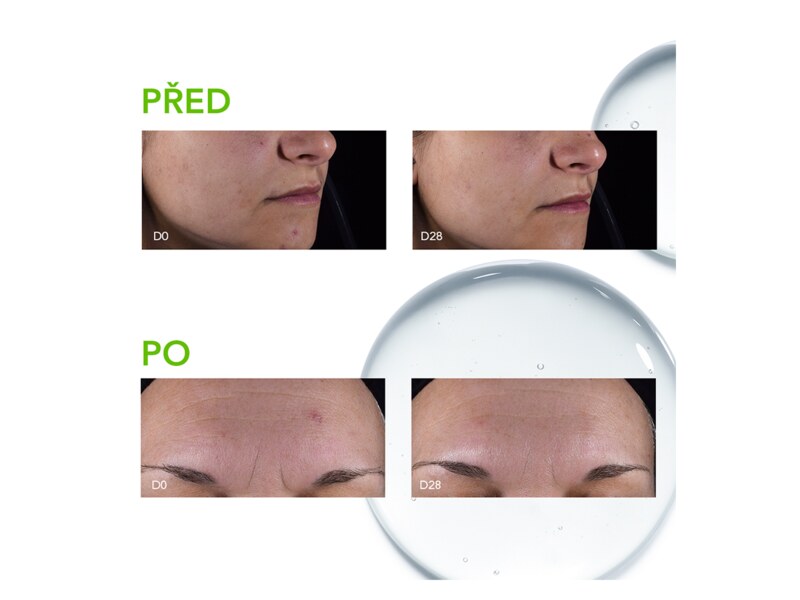 Bioderma Sébium Sérum, koncentrované sérum pro dospělou pleť se sklonem k akné 30 ml Bioderma Sébium Sérum, koncentrované sérum pro dospělou pleť se sklonem k akné 30 ml