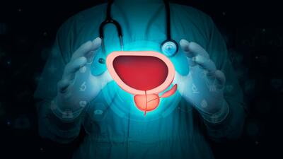 Zvětšená prostata – co je Benigní hyperplazie prostaty?