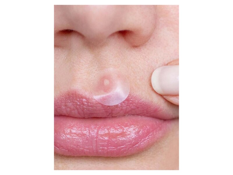 Breakout+aid Náplasti na ošetření akné s kyselinou salicylovou 72 ks 