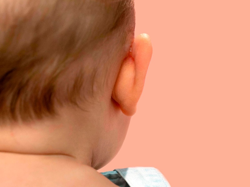 Otostick Baby korektor odstávajících uší pro děti 8 ks