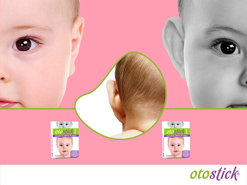 Otostick Baby korektor odstávajících uší pro děti 8 ks