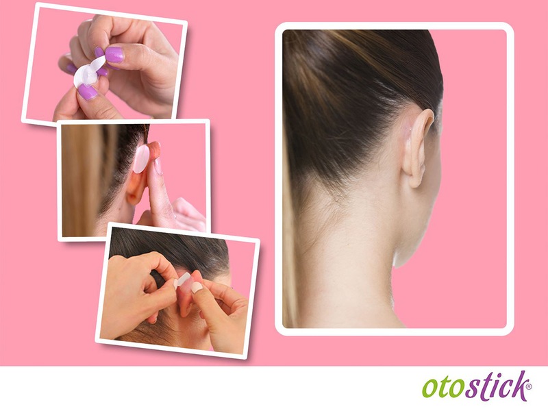 Otostick pro dospělé korektor odstávajících uší 8 ks