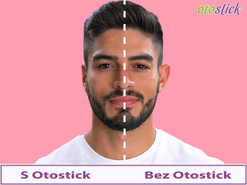 Otostick pro dospělé korektor odstávajících uší 8 ks