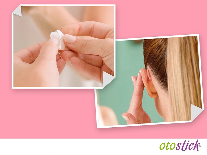 Otostick pro dospělé korektor odstávajících uší 8 ks