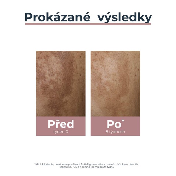 Eucerin AntiPigment Rozjasňující duální sérum 30 ml