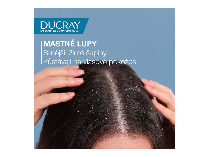 Ducray Kelual Squanorm šampon - Mastné lupy 200 ml