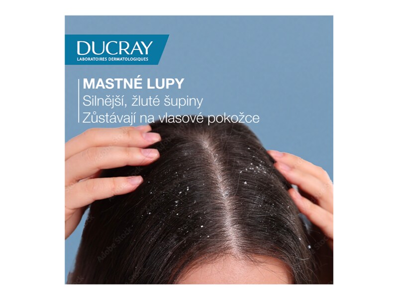 Ducray Kelual Squanorm šampon - Mastné lupy 400 ml Ducray Kelual Squanorm šampon - Mastné lupy 400 ml