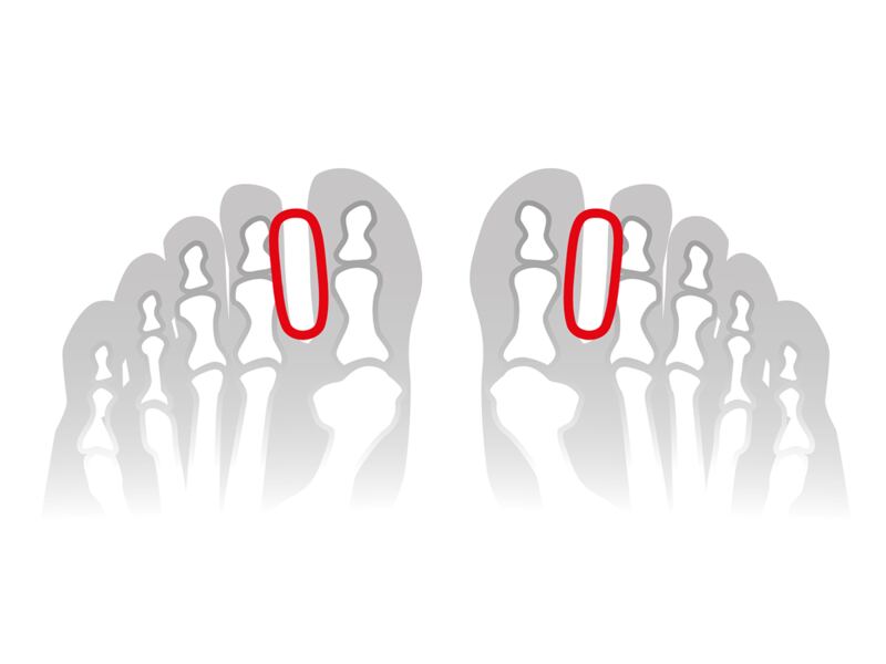 Svorto Gelový korektor meziprstí vel.M 1 ks