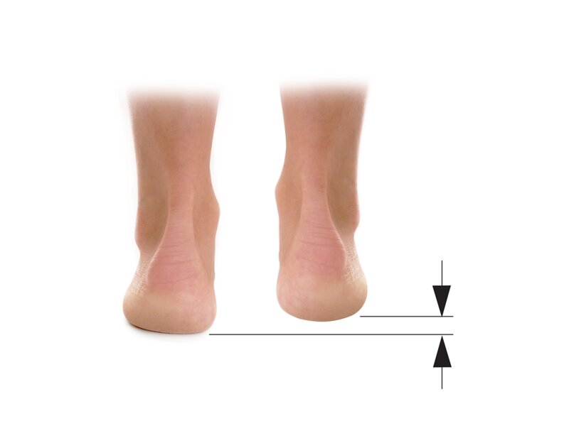 Svorto Podpatěnka korekční 0,5 cm vel.40-42 1 ks