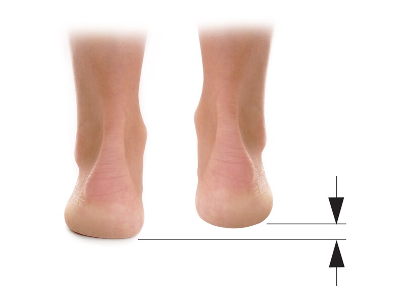 Svorto Podpatěnka korekční 1 cm (vel. 40-42) 1 ks