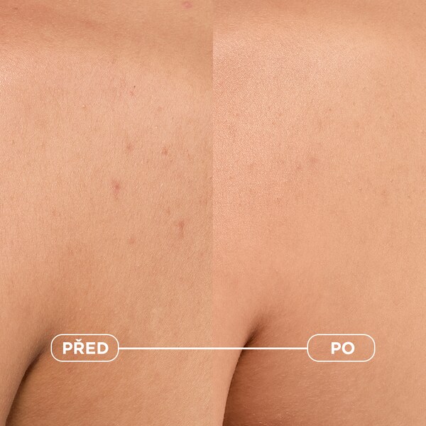 Bioderma Sébium Kerato+ Body sprej 150 ml