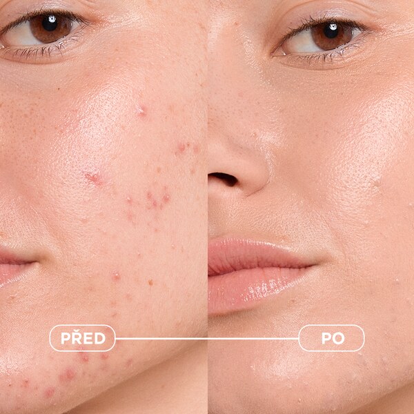 Bioderma Sébium Kerato+ Tónovací krém 30 ml