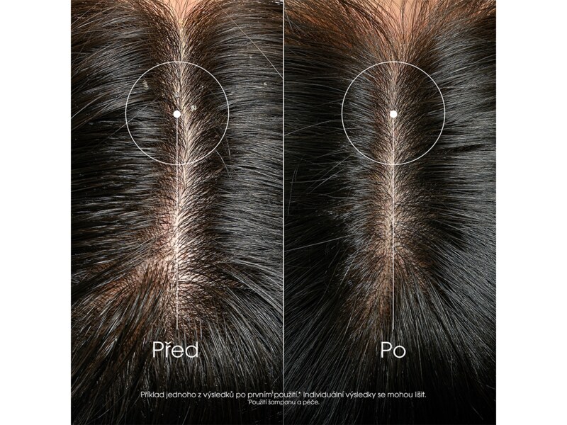 Klorane Šampon proti lupům s galangalem 400 ml