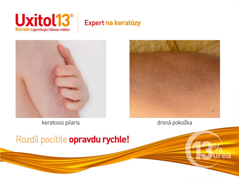 Uxitol 13 Kerato Zjemňující tělové mléko 250 ml