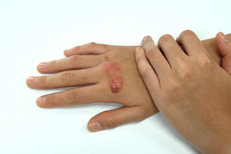 Repolar Abilar balzám na rány 20 g