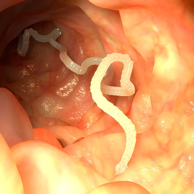 Parazitující červy - Parazitující červy Parazitující červy