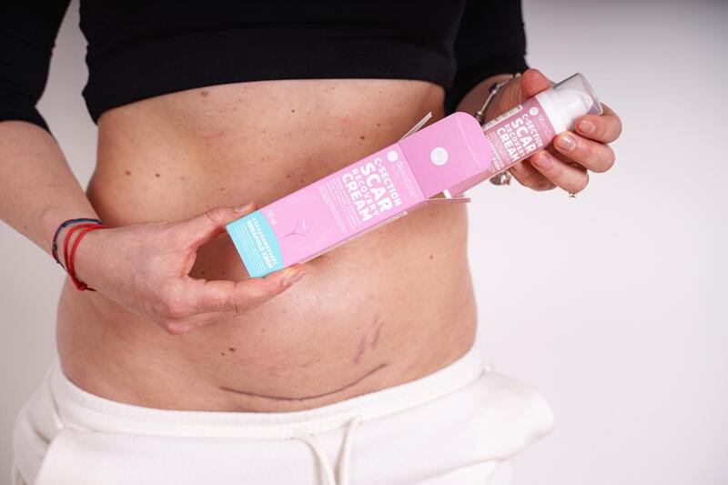 MomCare Krém na jizvy po císařském řezu 50 ml