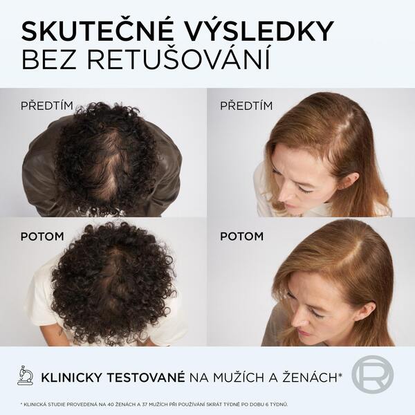 Loréal Elseve Growth Booster Sérum proti vypadávání vlasů 102 ml Loréal Elseve Growth Booster Sérum proti vypadávání vlasů 102 ml