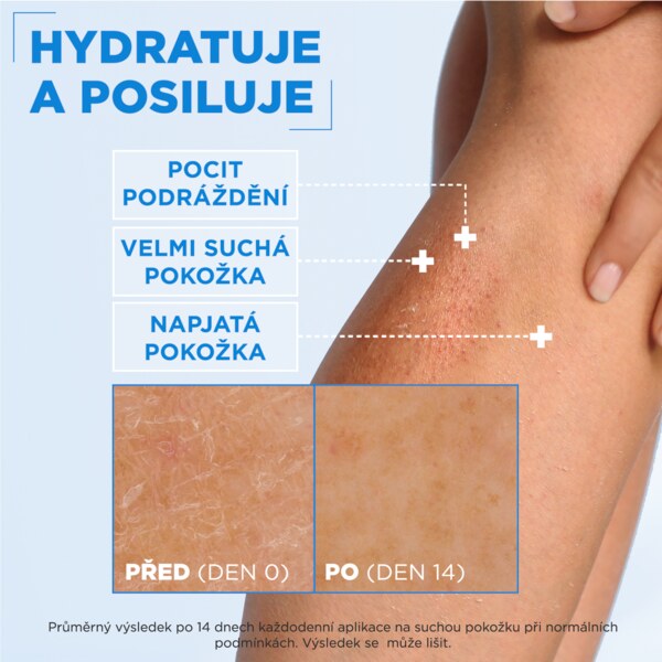 Mixa Ceramide Protect Posilující tělová péče 400 ml Mixa Ceramide Protect Posilující tělová péče 400 ml