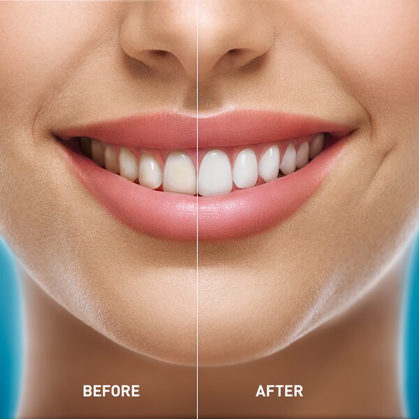 Mediblanc Whitening zubní pasta 100 ml Mediblanc Whitening zubní pasta 100 ml