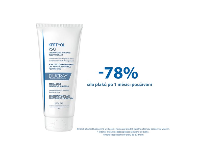 Ducray Kertyol P.S.O. keratoredukční šampon 200 ml Ducray Kertyol P.S.O. keratoredukční šampon 200 ml