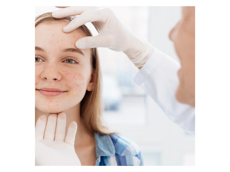 Avene Cleanance ComedoMed koncentrovaná péče při nedokonalostech pleti 30 ml