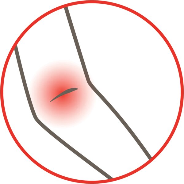 A-Derma Cutalgan Ultra zklidňující spray 100 ml 