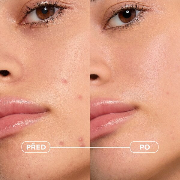 Bioderma Sébium Kerato+ 30 ml